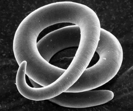 Trihinella_cikl_razvitiya_i_forma_tela