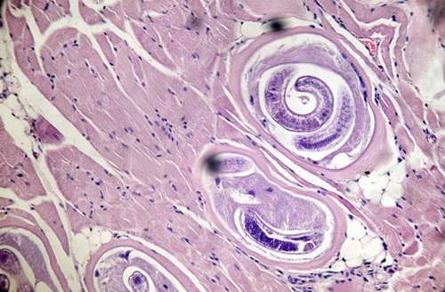 Trihinellez_Simptomi_i_priznaki_bolezni-_metodi_lecheniya_trihinelleza