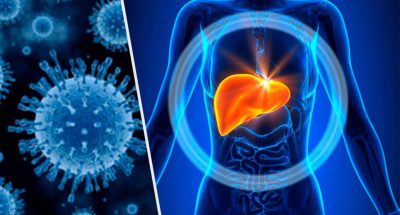 1532725448_Hepatitis__Enfermedad_que_padecen_millones_sin_saberlo1532725448418
