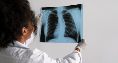 side-view-doctor-looking-radiography_23-2149844589