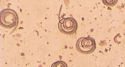 Trichinella spiralis - parasitic worm in muscle in microscope