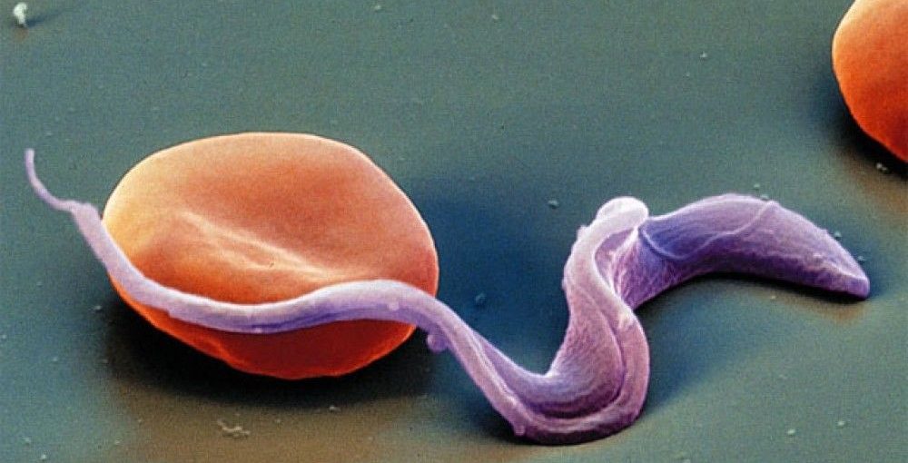 toxoplasma_gondii
